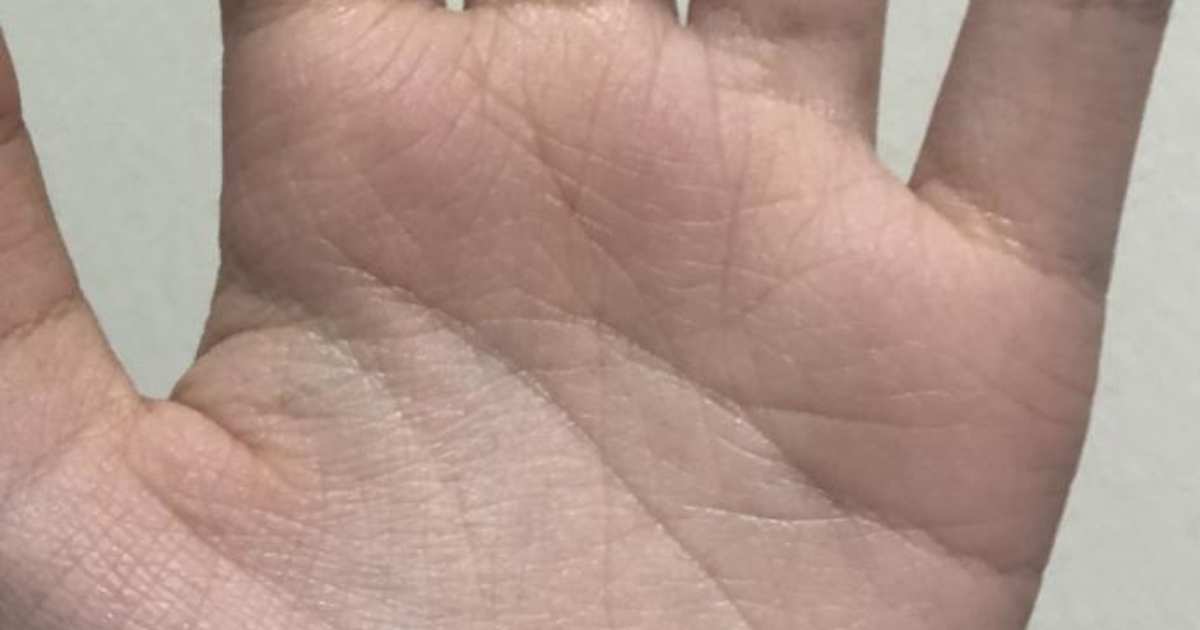 Why r my hands so wrinkly? GirlsAskGuys