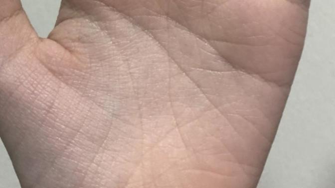 Why r my hands so wrinkly?