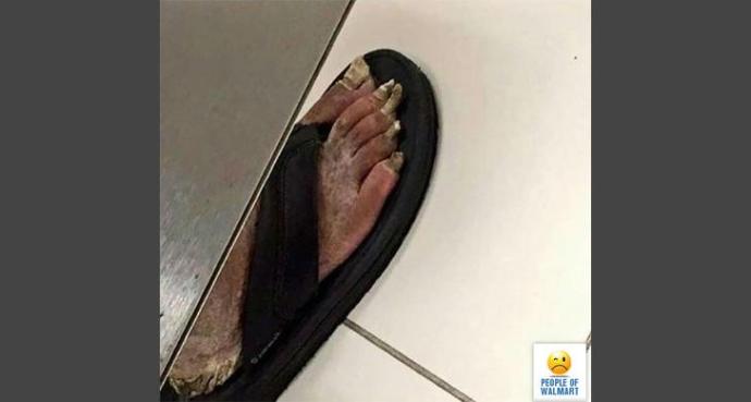 Have you ever been prohibited from wearing your feet?