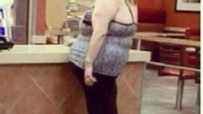 Has the sight of a morbidly obese person ever made you physically ill?