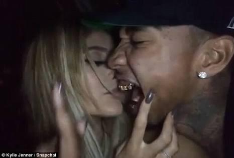 Why did the guy I’m seeing kiss my lips and bite them so hard that my lip became raw?