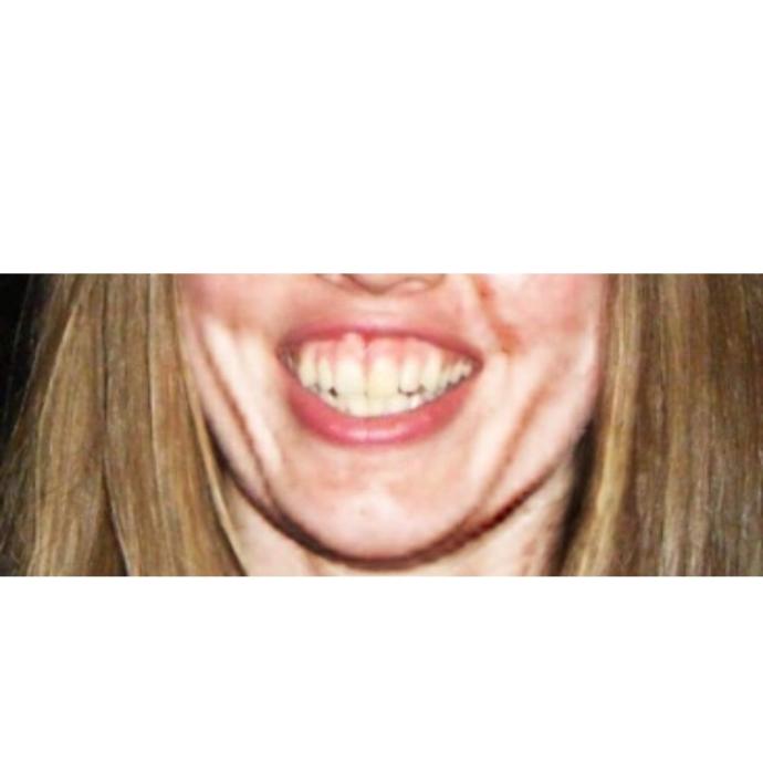 Can a great smile really make someone beautiful?