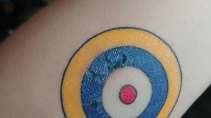 Is my tattoo infected?