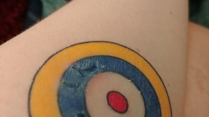 Is there something wrong with my tattoo? Infected?