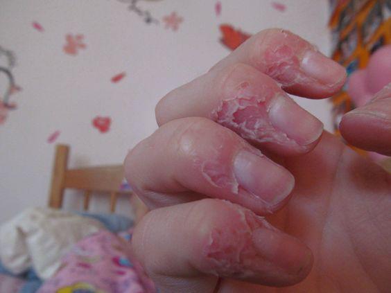 Gross.