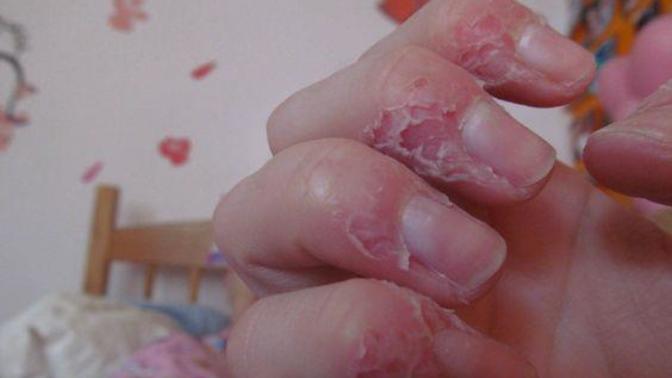 How do you feel about girls who bite/pick at their nails/fingers?