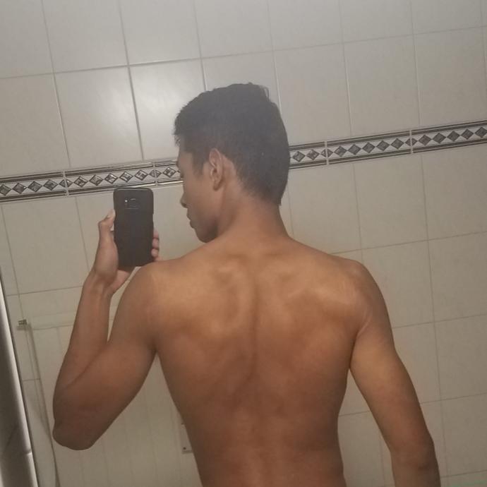 Hard to see, but try zooming in. They're the white streaks around most of my upper back and rear shoulders
