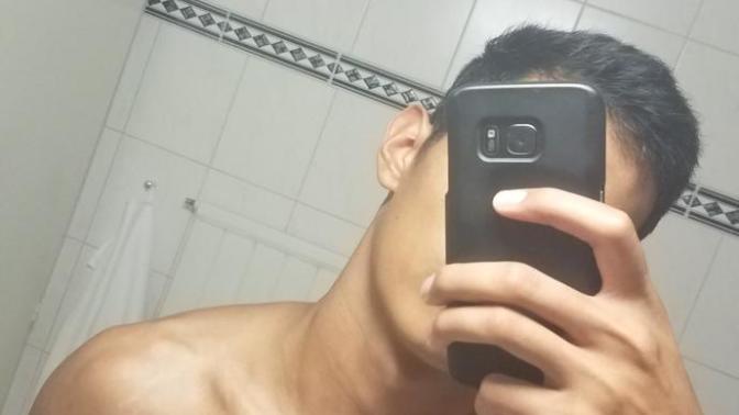 Are stretch marks on guys a turn off?