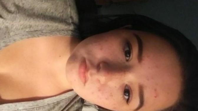 What Plastic Surgery Should I Get?