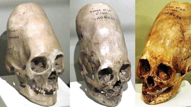 What do you think of my theory that some elongated skulls could've been the result of incestuous procreation?