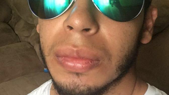 Do girls really find big lips unattractive?