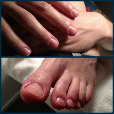 Men Wearing Clear Nail Polish Saskguys Men Wearing Clear Nail Polish