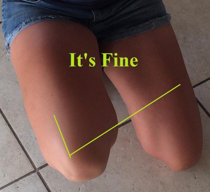 Do bare thighs bother you?