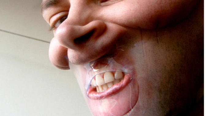 Will you buy a face corset?