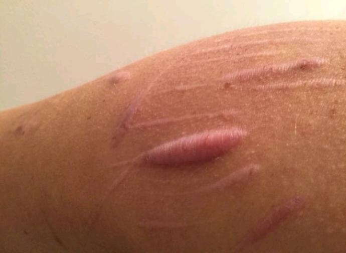 Are self harm scars on multiple areas of the body a turn off?