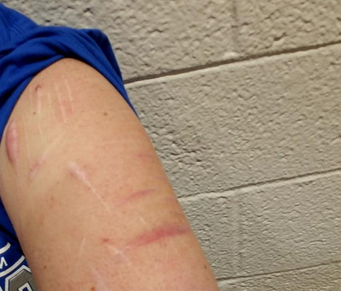 Are self harm scars on multiple areas of the body a turn off?