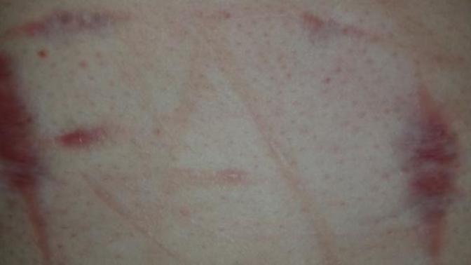 Are self harm scars on multiple areas of the body a turn off?
