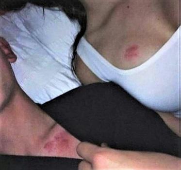 Have you left a hickey on someone? Do you like getting them?