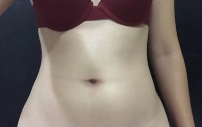 What can I do to lose lower belly fat?