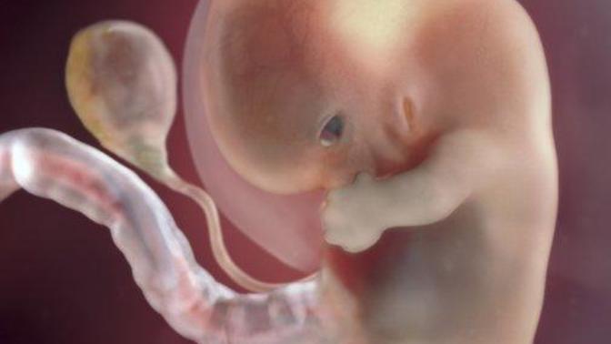 How do you justify Abortion?