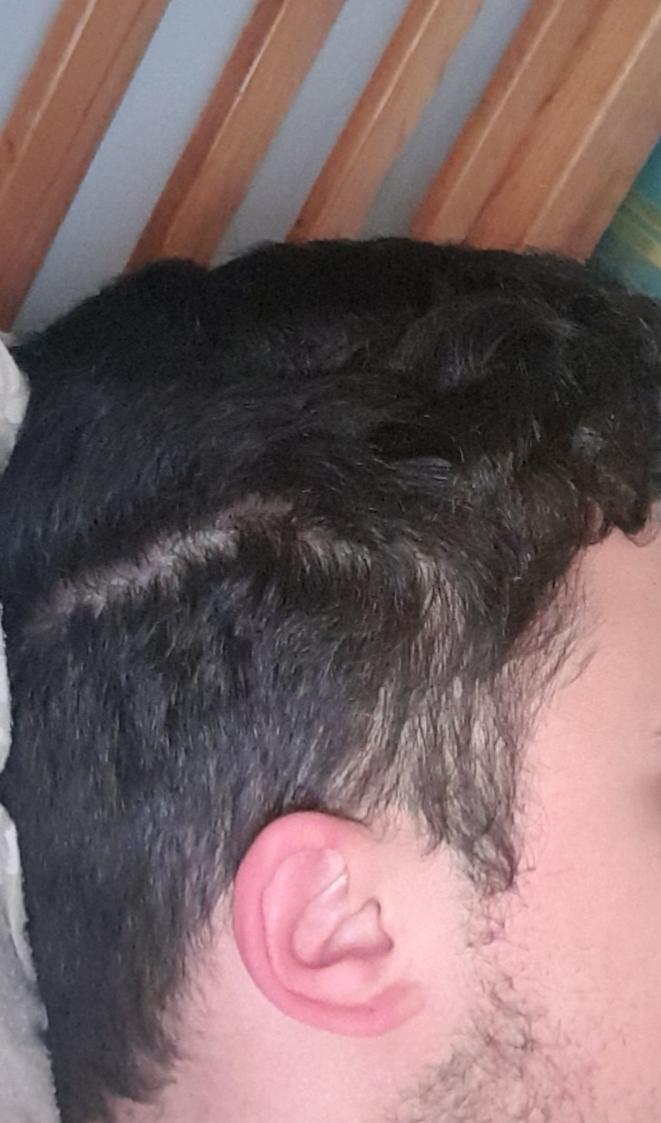 Does it look like I'm going Bald or is it just the way my hair is styled?