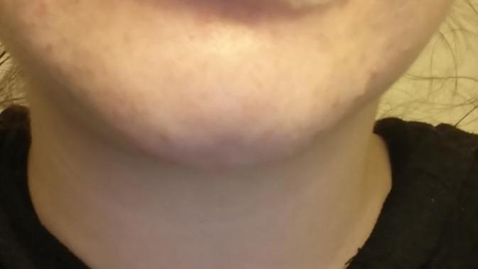 Would you leave the house with this on your face?