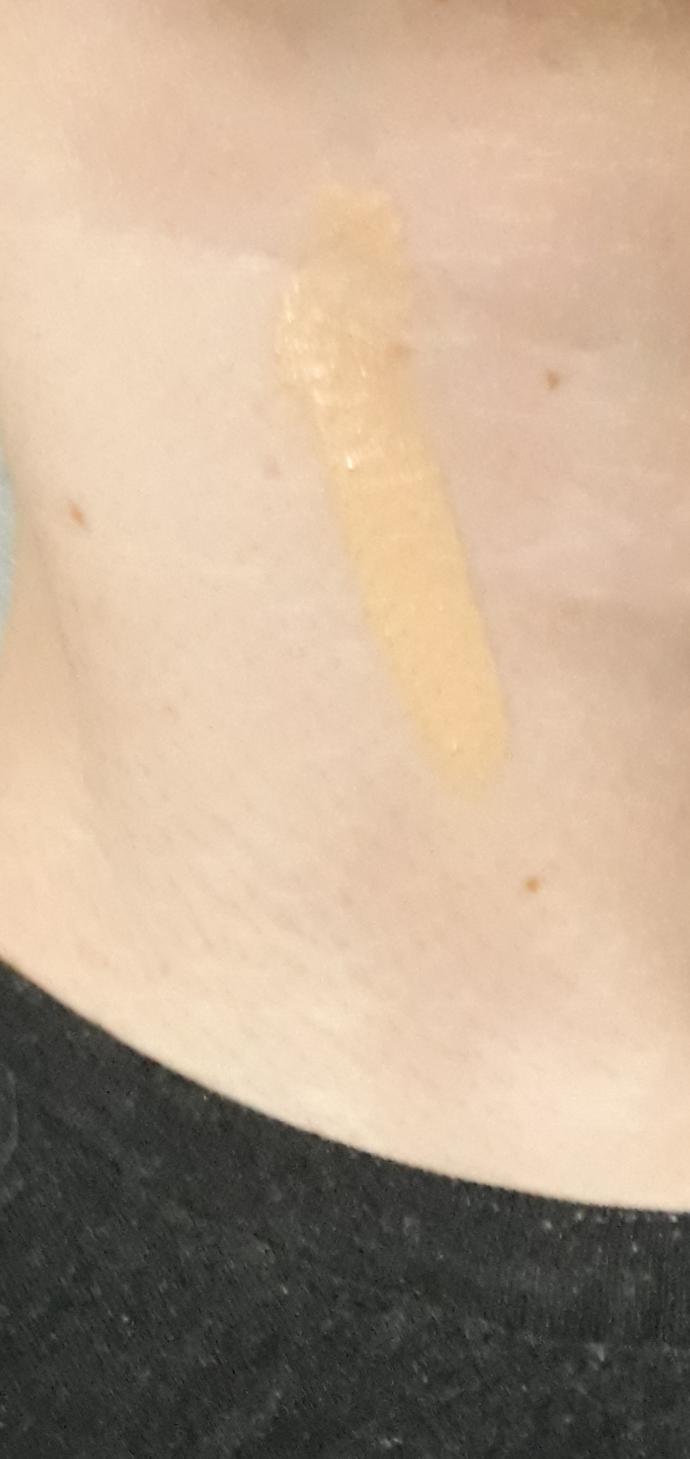 On my neck