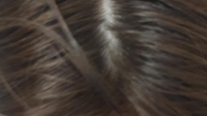 Am I balding? I think I am?