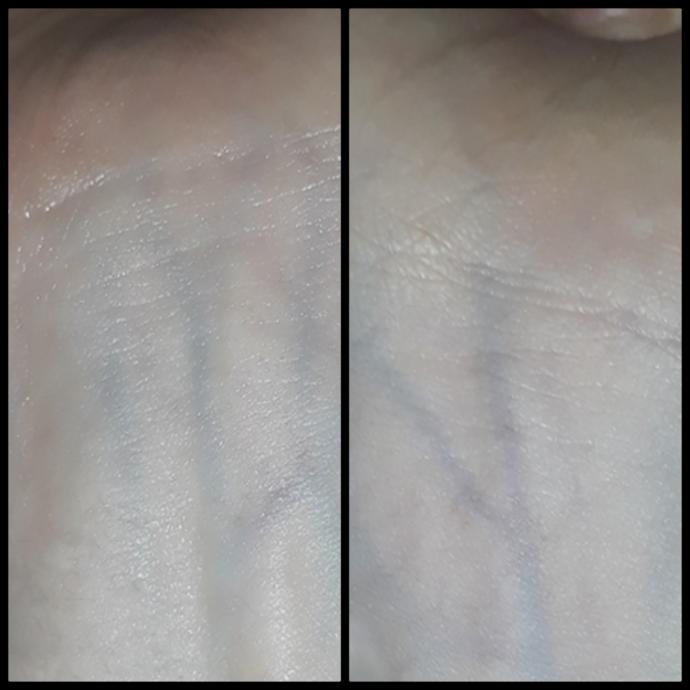 My vein colour