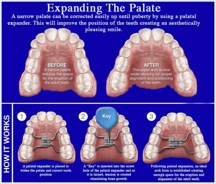 How much do having nice teeth / an aligned jaw factor into attractiveness?