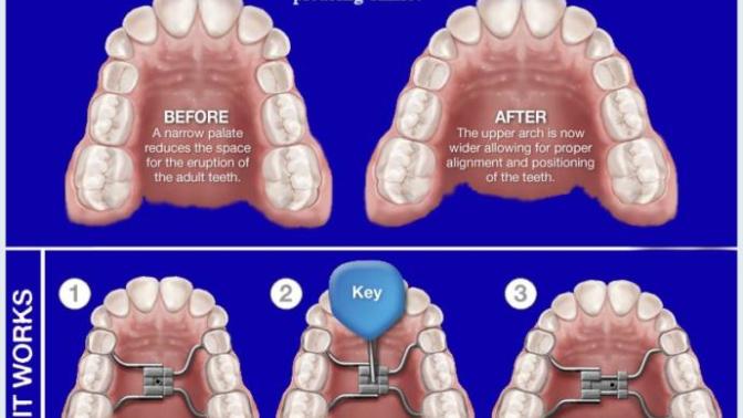 How much do having nice teeth / an aligned jaw factor into attractiveness?