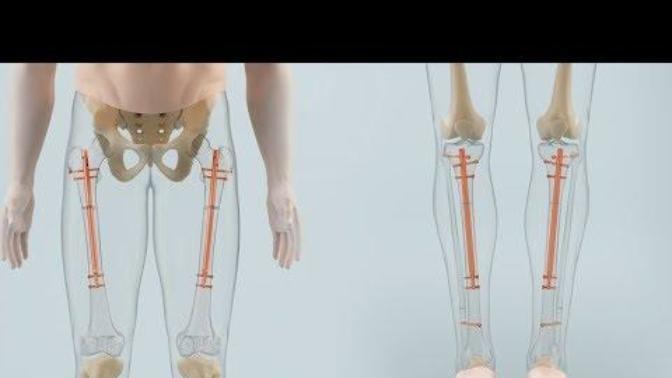 What is the ideal leg length for women?