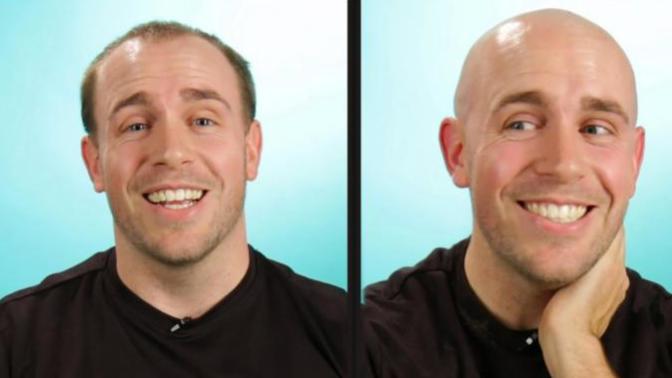 Ladies, what would you think/do if your man went bald?