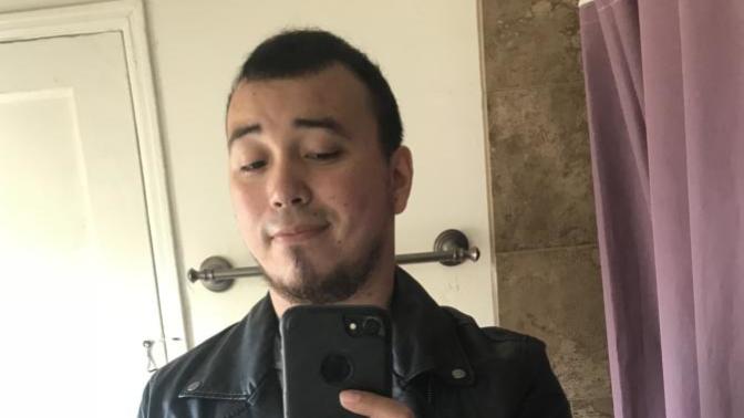 Do o still look good with a receding hairline?