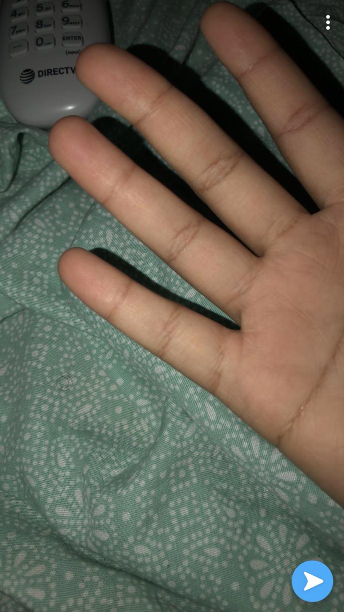 Do people realise black hands have white palms?