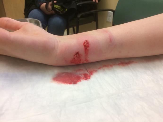 I got a dog bite on my wrist. How bad does it look?
