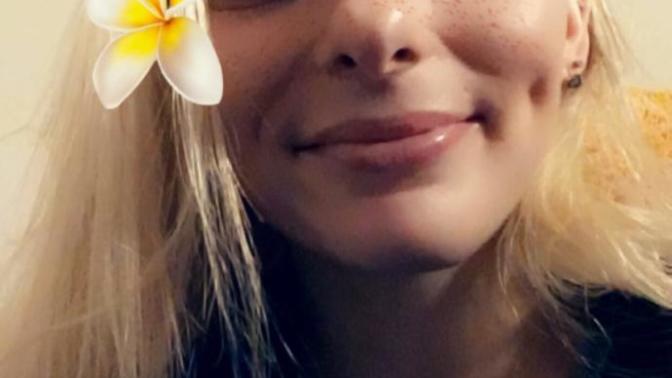 Why do I only have one dimple now?