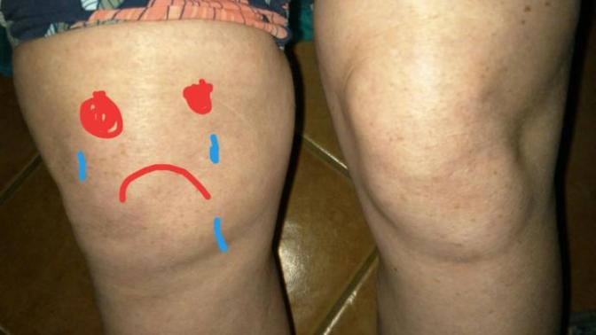 I have a really sore knee is it possible to get a little sympathy 😢?