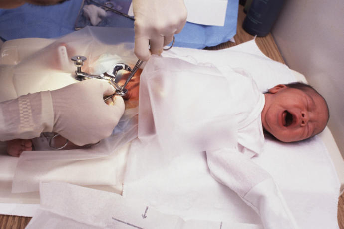 Is circumcision necessary?