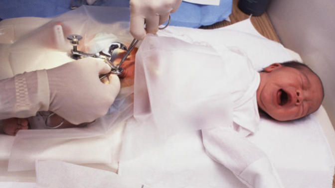 Is circumcision necessary?