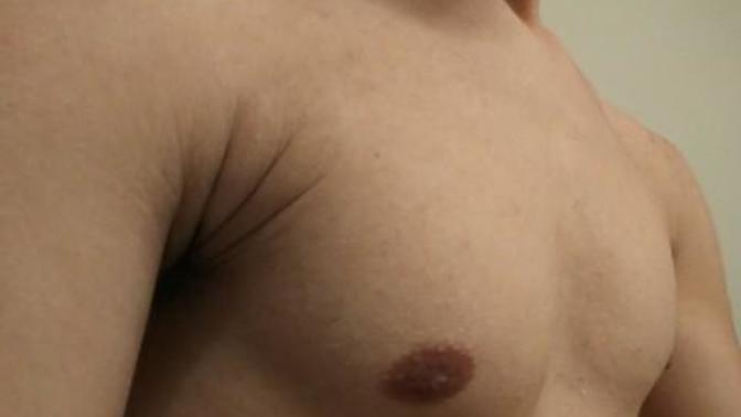 How to get rid of these armpit creases?