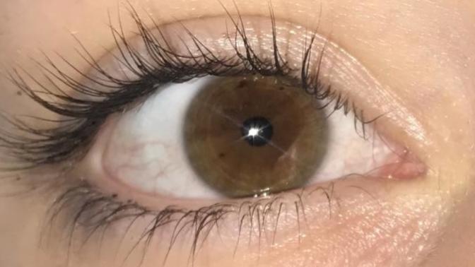 Would u say I have green on the outer ring of my eye? I feel like I don’t have solely brown eyes?
