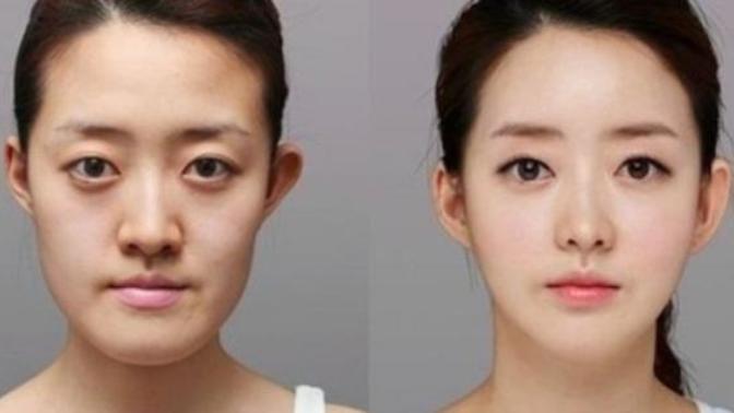 What is Your Opinion on Plastic Surgery?