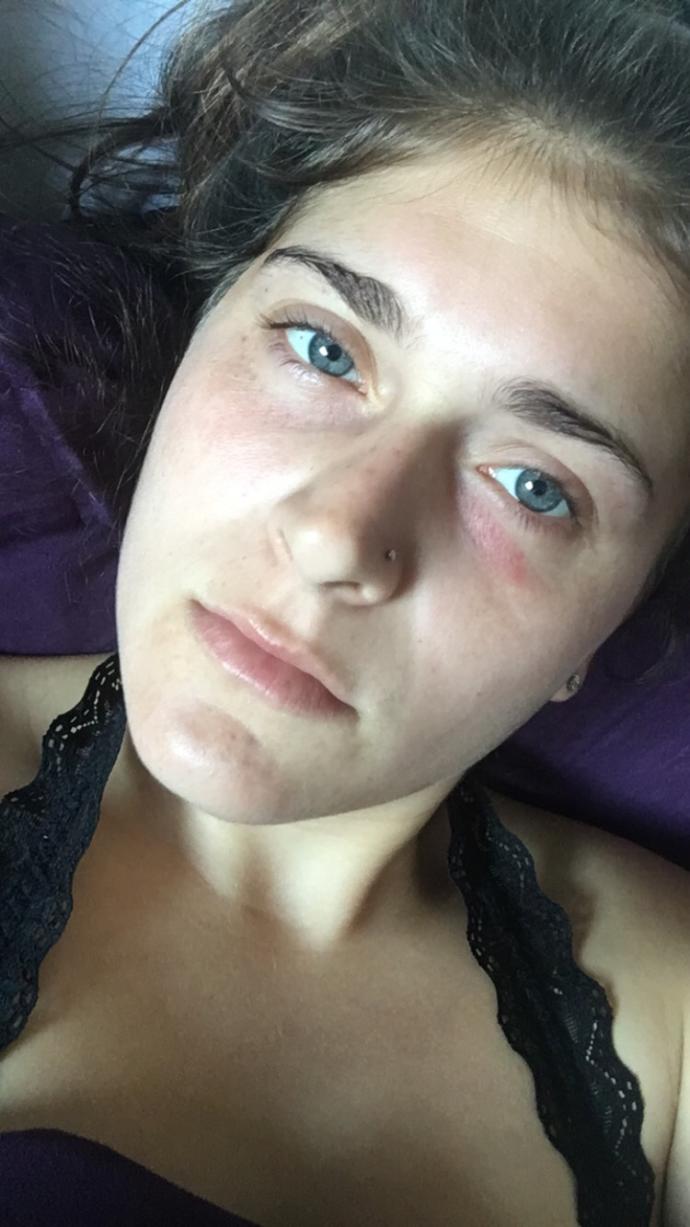 Are there any dermatologists or doctors here that know why I have these