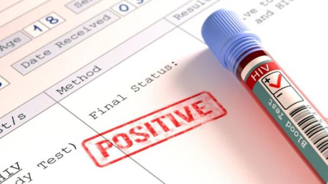 Would you date a person with HIV?