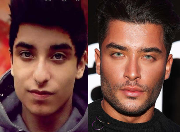 Do you think male plastic surgery looks good?