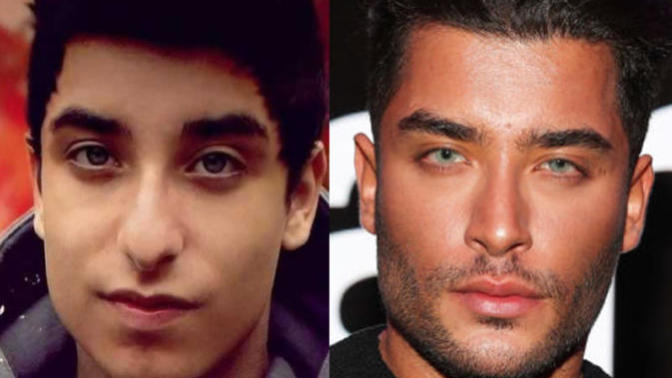 Do you think male plastic surgery looks good?