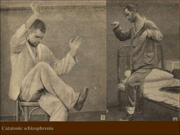 Schizophrenia: Has anybody suffering had a expierence with catatonia, posturing, or wax posing?