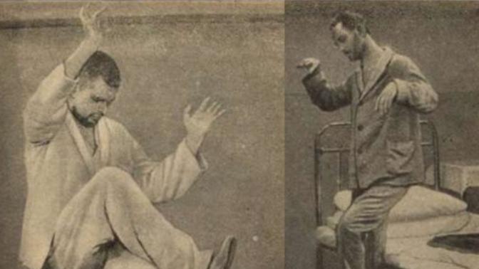 Schizophrenia: Has anybody suffering had a expierence with catatonia, posturing, or wax posing?