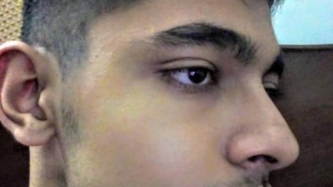 Are plump lips on a guy a turn off for women?